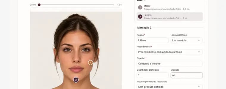 Tela do Esthetis: Guia completo: plano de harmonização e estoque de injetáveis